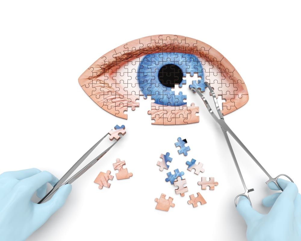 CATARACT SURGERY