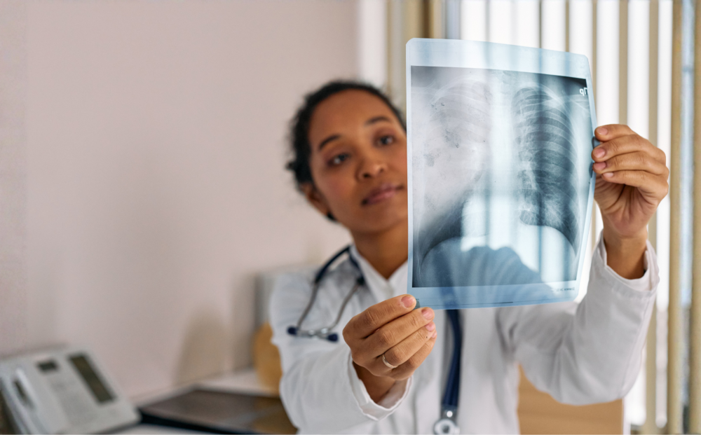 TB & CHEST PHYSICIAN